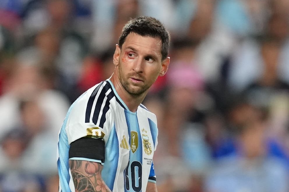 Copa do Mundo 2026: Agora semifinal contra Kane: vitória sangrenta de Lionel Messi na Argentina – Suíça | esportes